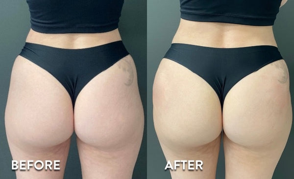 Before and after result