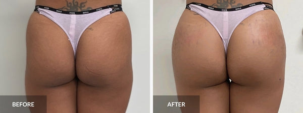 Before and after result